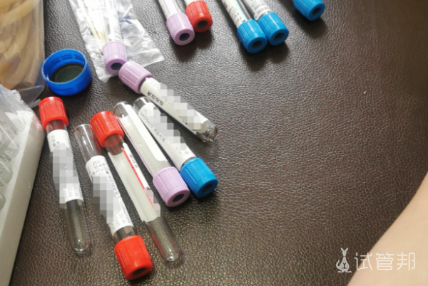 7be9675233238bbd6945ad35f413c8a2.png 血常规23项能检查出什么