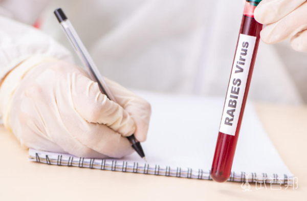 bb379bb2a15881fe3fdd234105d3739b.png 女性血常规检查项目包括哪些