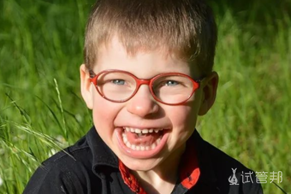 006910e6c0c4959cb4eae309edfd8bf8.png 天使综合征治疗方法有哪些