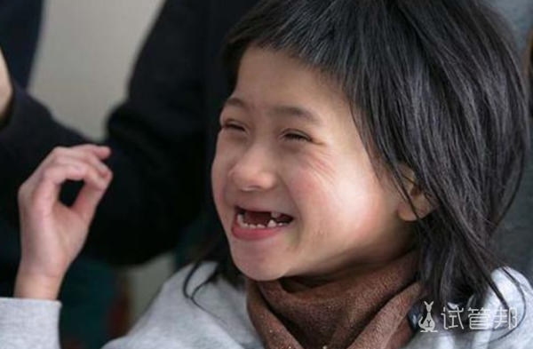 690d5abf5022d418f6ac2546067f4b5f.png 天使综合征的面容图片