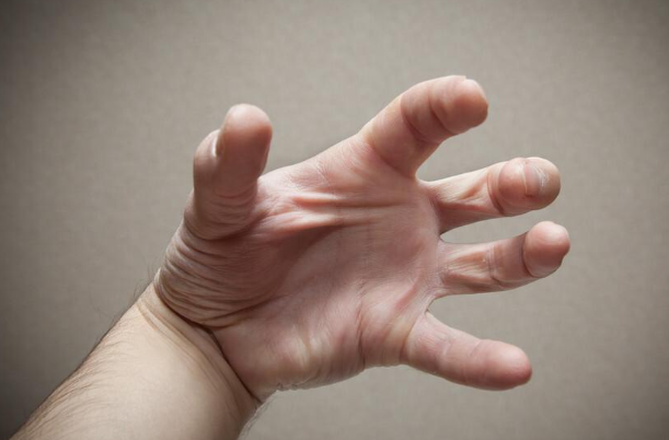 816b4c0b50fa354b52a557ee3360c2d6.png 羊角风怎么治疗