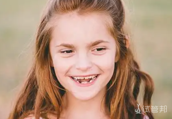 838e0c07ade6193fa1dd79fbc7fba76d.png 天使综合征的平均寿命是多少年