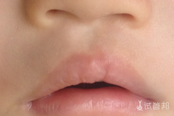 a424892905ed971ec7e97e6c309ed09f.png 怀孕吃兔肉会变兔唇吗