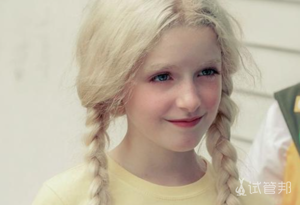 ca235360f399c099d09824d1a80bbcf2.png 天使综合症临床表现有哪些