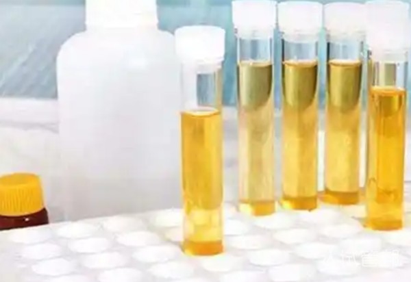 02c8ebc194de0df7c9c183834f421cd6.png 尿酸碱度偏低怎么办