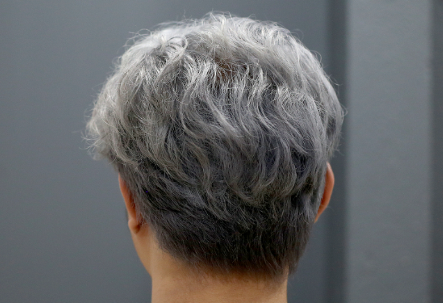 07f53cba7af64fbcdeef4e1b7bd59b61.png 少白头是不是肾虚引起的