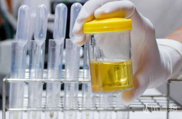 2072f1d00895f27b9e98927d005ec201.png 尿酸碱度7.0有什么危害