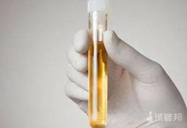 31490977bb39ea39c9bfb6a09781db45.png 孕妇尿酸碱度看男女准吗