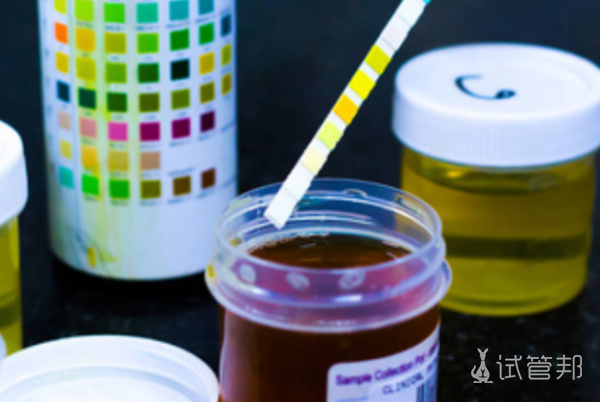 3ae0827b010de90246f2510bd4683d4f.png 尿酸碱度7.0是什么意思