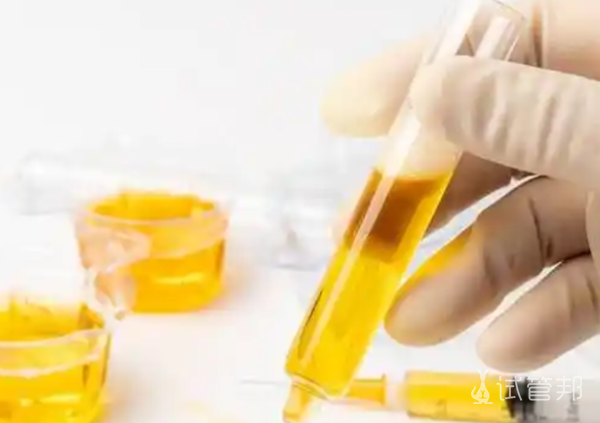 416f6cd39b2b355a526198e38cd78a47.png 尿酸碱度是尿酸吗