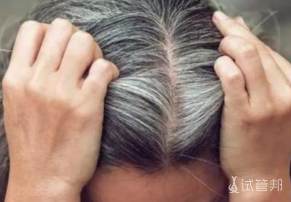 4390e9380d06a53c12c387f7b431904c.png 少白头怎么解决