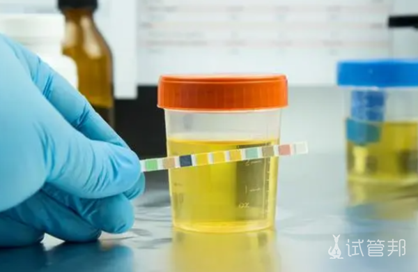 51802e8c3c737731587b160a2cd9bb51.png 女性酸碱度偏高有什么影响