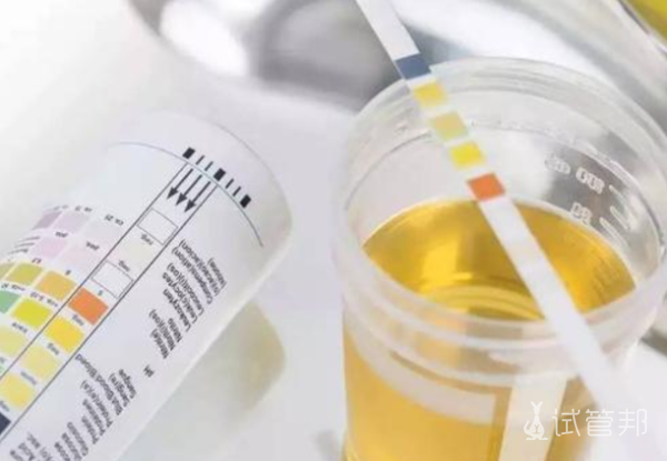 54eca52ca8d24741735617583c8857c2.png 尿酸碱度6.0是酸性体质还是碱性体质