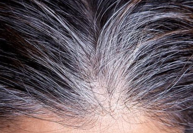 55ed3999f4dd2ac50c3e82c09f79453c.png 少白头的人能长寿吗