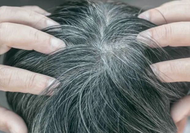 695151b19d14a80160d452fc7650bae3.png 少白头怎么变黑