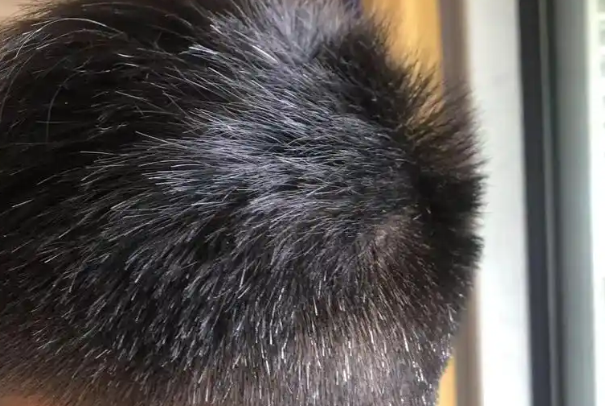 76e6c041ce5b8fdf60831fd82c0aba77.png 少白头是什么原因导致的