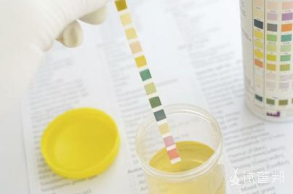 77e1ce5bce6495abde37caa5838de7cf.png 尿酸碱度低5.0怎么回事