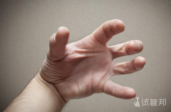 80b11373f5c7d49f018ad009d0d69f02.png 羊癫疯是什么原因引起的