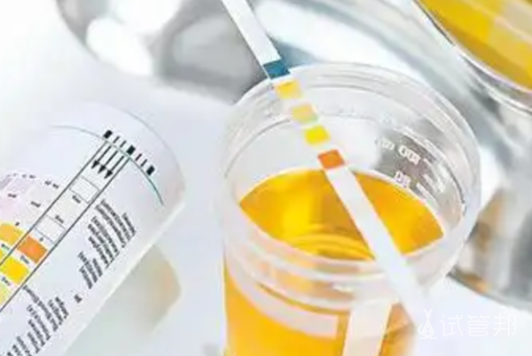 9653ff82960efd15134a03c6323869e5.png 尿酸碱度5.0严重吗