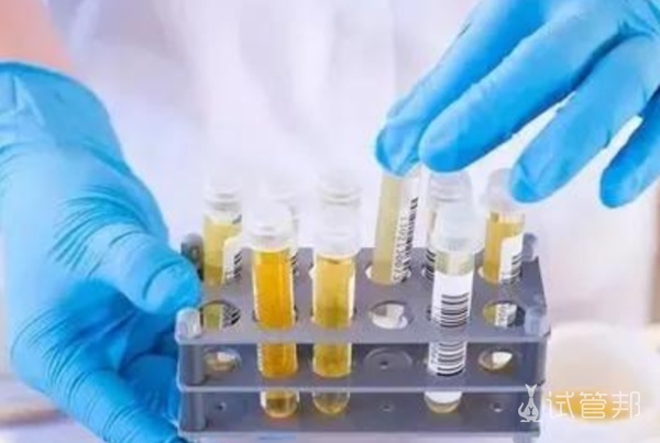 baba40347ca375d9a387637b681ec99e.png 尿酸碱度6.0正常吗