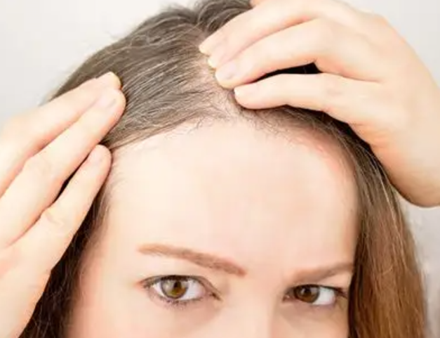 c4140f0a92cceb8abe8991842e91e253.png 少白头能治好吗