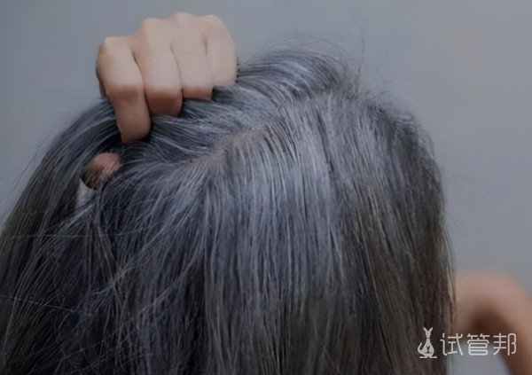 c46f192ad37317cd67f3c4d4a9c9f93c.png 少白头的人寿命短吗