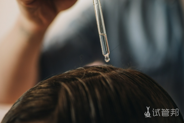 c7cca1cd915bc7a74dc14668f575f9d9.png 少白头遗传几率有多大