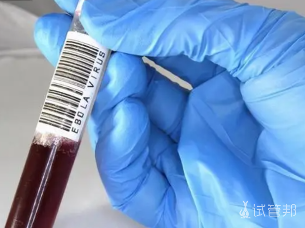 c875c0cdc70adb269f1f085355513c86.png 血精症需要手术吗