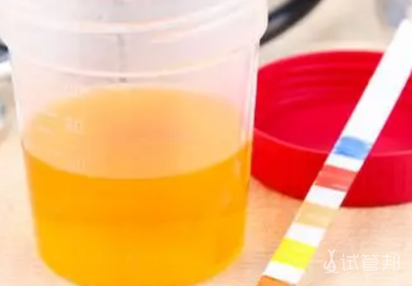 cbacbdcc96fbaa815ceaefc31bd26612.png 尿酸碱度是高好还是低好