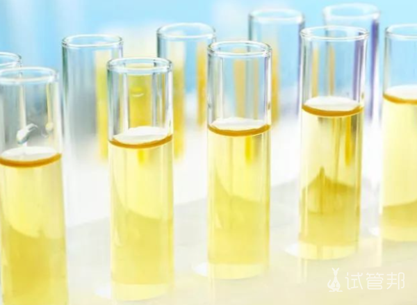 cf3e8019eb9e2d479ee7ba145bacae32.png 尿酸碱度偏低是什么原因