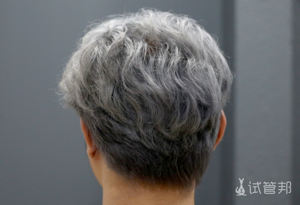 cfc9e5f3df7a96dcb3c9f36599353915.png 少白头调理变黑发要多久