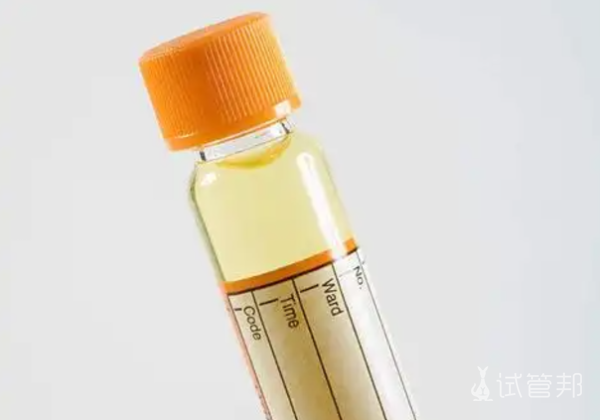 edd336335b7f3d81671179c9dda47df2.png 尿酸碱度低5.0需要吃药吗