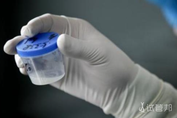 ee6b6ba1baad0f204ecae7ef1cfc6296.png 精液稠怎么治疗比较好