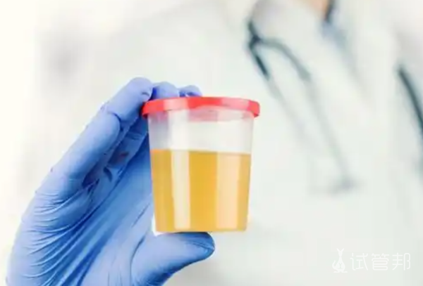 f8cc70632708092a52e398f38c1242b9.png 尿酸碱度5.0正常吗