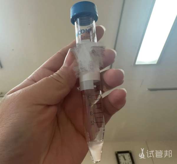 11c3bfe13f0a0b3584841112085a69c7.png 第一次做人工授精来分享一下我的经历