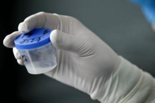 d5cc024decbd9d78d98a0066c68645c2.png 血精症影响生育吗