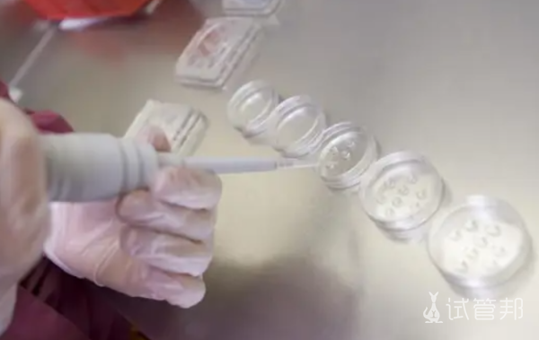 dd4d1649c86c4ef4de3ec648c7a48198.png 畸形弱精症可以怀孕吗