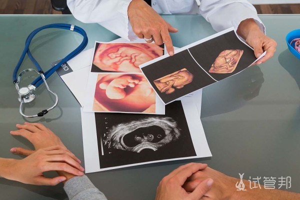 dbea95a4bf879472f8feb0c801c70fea.jpg 一个月人流对女性伤害有多大