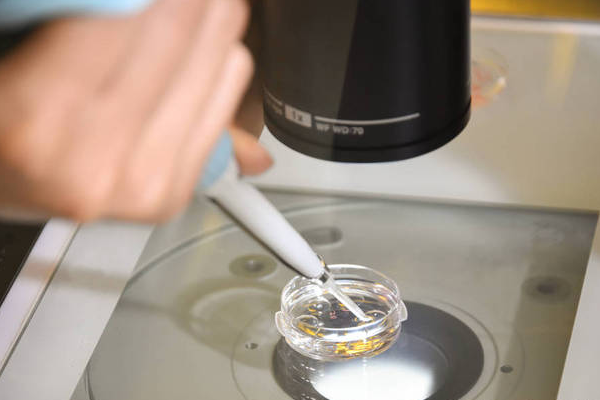 022074d18310955b9d8162f267f42901.png 试管婴儿技术的发展