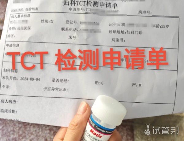 fd0d19000a14aefe7ba605880e8d5ae4.png 为什么要做宫颈筛查