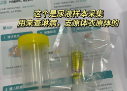 艾滋病症状全解析，你真的了解它吗？