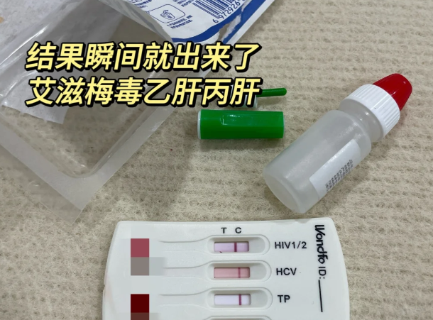 艾滋病初期症状现身时间揭秘