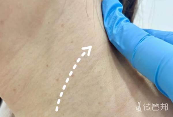 a8b380e88b7ab598795e77102dd244d1.png 医生揭秘梅毒的5大警示信号