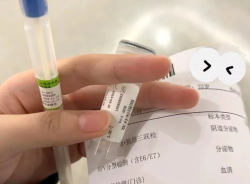 HPV与艾滋病？别再混淆啦！