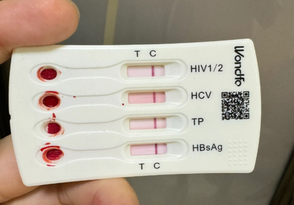 3种性病的具体介绍感兴趣的姐妹快来看哦