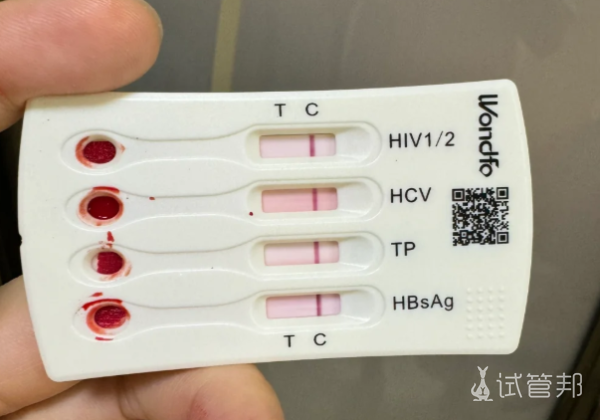 e920f188a92356cec48885f34dd019df.png 3种性病的具体介绍感兴趣的姐妹快来看哦