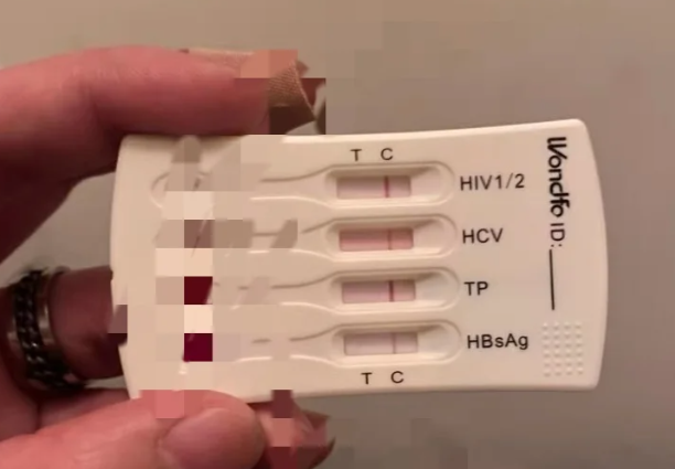 HPV与艾滋病你真的分清了吗