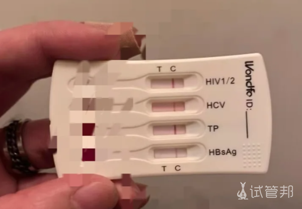 f8c3fbae0daa639a53e6f3f3f3c11437.png HPV与艾滋病你真的分清了吗