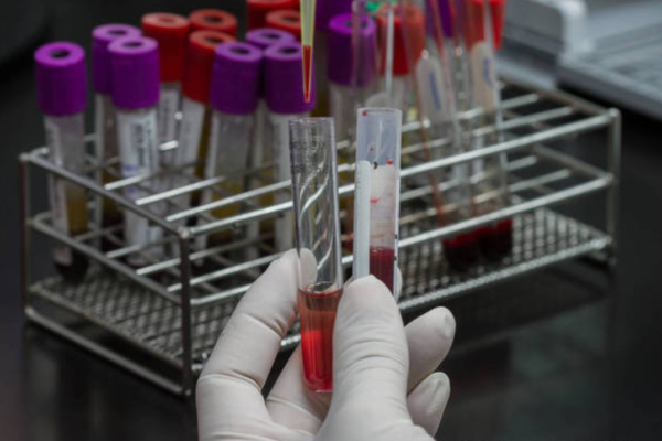 fb08971c378bc72070b1b9fb8a3d49a8.png 试管婴儿移植保胎误区有哪些