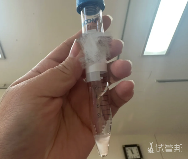 2e0157fa8e612601ef171cecdbeab4b3.png 第一次人工授精经历希望能成功